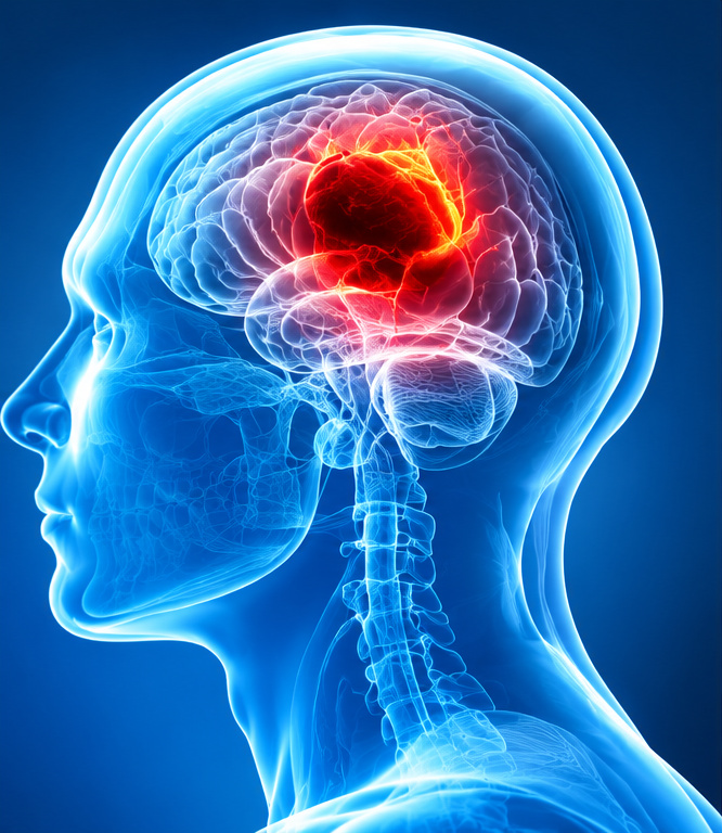Brain and neurosurgery medical illustration